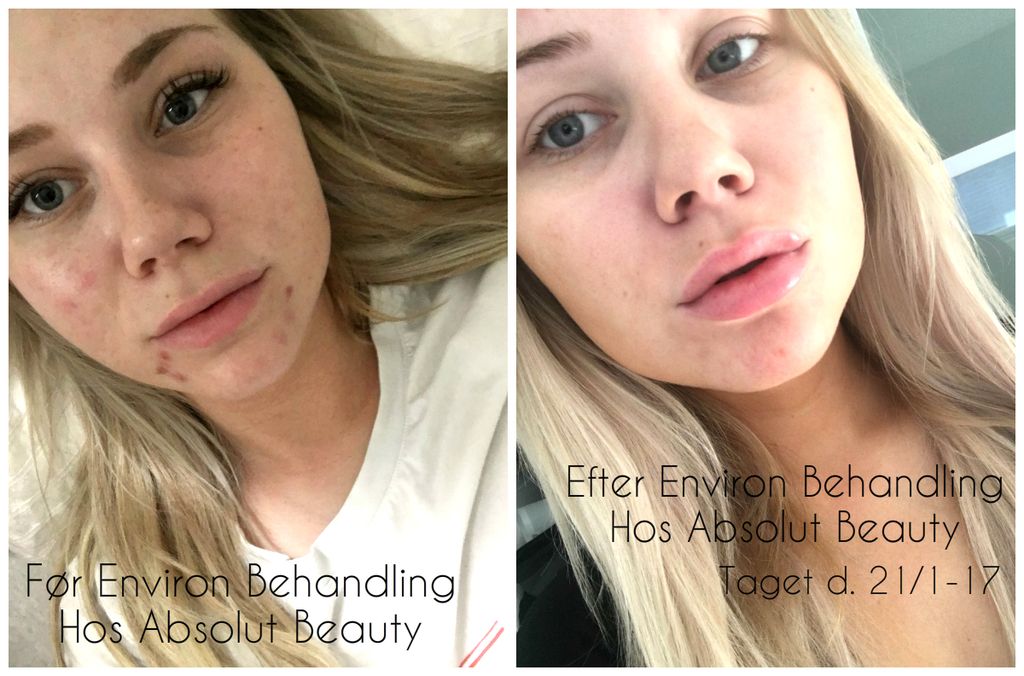 Abslout Beauty
