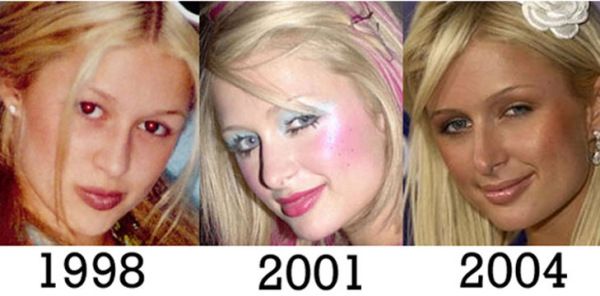 Nose Job Photobucket